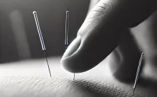 close up balck and white image of acupuncture needles gently inserted into the skin. The photo focuses on the precision and delicacy of the needles, with a smooth skin texture in a calm, meditative atmosphere. The minimalist design emphasizes healing and serenity, with soft lighting creating a therapeutic mood.